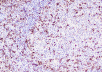 CD2 Recombinant Rabbit Monoclonal Antibody