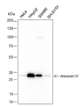 Annexin IV Recombinant Mouse Monoclonal Antibody