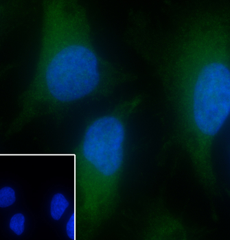 Annexin IV Recombinant Mouse Monoclonal Antibody