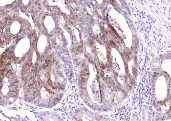 S100P Recombinant Rabbit Monoclonal Antibody