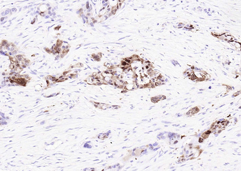 S100P Recombinant Rabbit Monoclonal Antibody