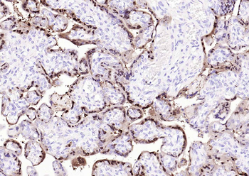 S100P Recombinant Rabbit Monoclonal Antibody