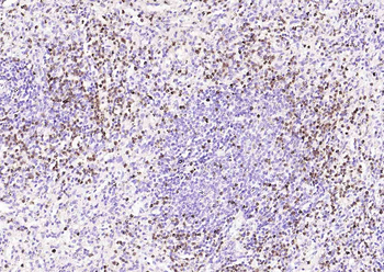 S100P Recombinant Rabbit Monoclonal Antibody