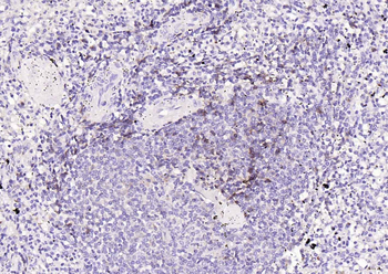 CD23 Recombinant Rabbit Monoclonal Antibody