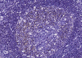 CD23 Recombinant Rabbit Monoclonal Antibody