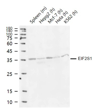 EIF2S1 Recombinant Rabbit Monoclonal Antibody
