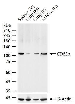 CD62p Recombinant Rabbit Monoclonal Antibody
