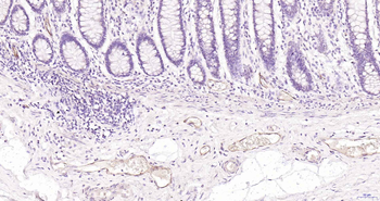 CD62p Recombinant Rabbit Monoclonal Antibody
