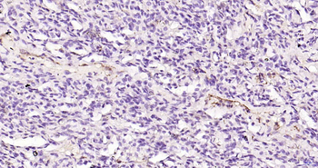 CD62p Recombinant Rabbit Monoclonal Antibody