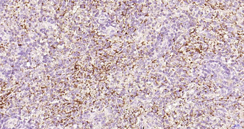 CD62p Recombinant Rabbit Monoclonal Antibody