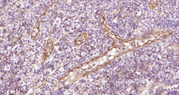 CD62p Recombinant Rabbit Monoclonal Antibody