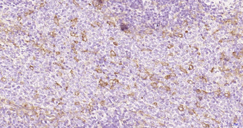 CD62p Recombinant Rabbit Monoclonal Antibody