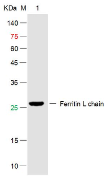 Human Ferritin Light Chain Mouse Monoclonal Antibody