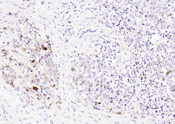 Prostate Specific Antigen Mouse Monoclonal Antibody