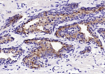 Prostate Specific Antigen Mouse Monoclonal Antibody