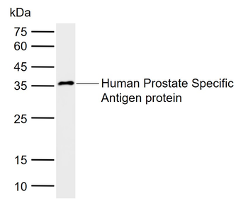 Prostate Specific Antigen Mouse Monoclonal Antibody