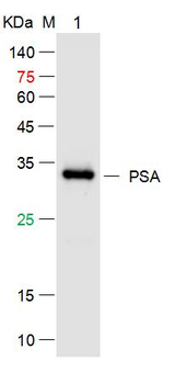 Prostate Specific Antigen Mouse Monoclonal Antibody
