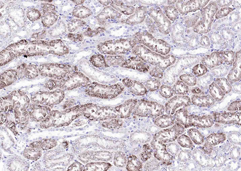 Catalase Recombinant Mouse Monoclonal Antibody