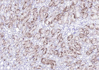 Catalase Recombinant Mouse Monoclonal Antibody