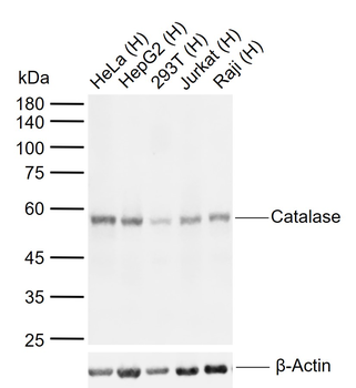 Catalase Recombinant Mouse Monoclonal Antibody