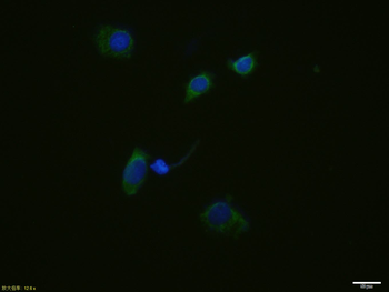 FIS1 Recombinant Mouse Monoclonal Antibody