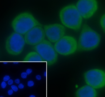 MUC2 Rabbit Polyclonal Antibody