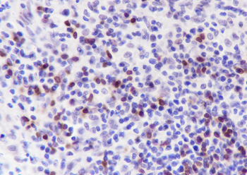 BOB-1 Recombinant Rabbit Monoclonal Antibody