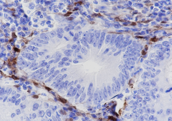 IDO1 Recombinant Rabbit Monoclonal Antibody