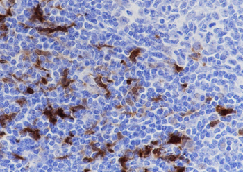 IDO1 Recombinant Rabbit Monoclonal Antibody