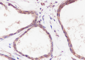 MAP4K4 Recombinant Rabbit Monoclonal Antibody