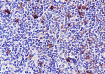 CD134 Recombinant Rabbit Monoclonal Antibody