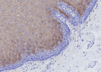 Keratin 4 Recombinant Rabbit Monoclonal Antibody
