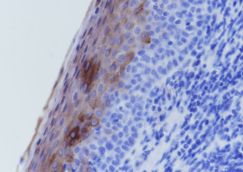 Keratin 4 Recombinant Rabbit Monoclonal Antibody