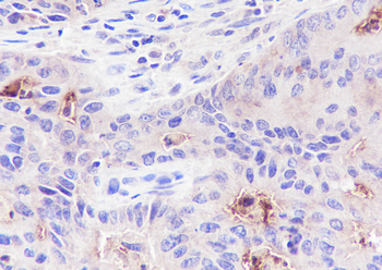 CD66a Recombinant Rabbit Monoclonal Antibody