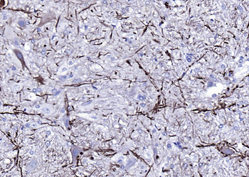 NF-L Mouse Monoclonal Antibody