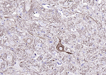 NF-L Mouse Monoclonal Antibody