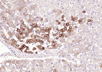 SMAD7 Mouse Monoclonal Antibody