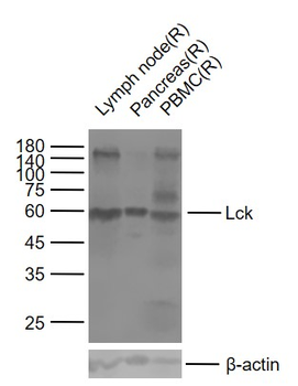 Lck Rabbit Polyclonal Antibody