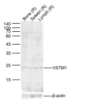VSTM1 Rabbit Polyclonal Antibody