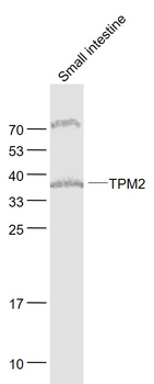 TPM2 Rabbit Polyclonal Antibody