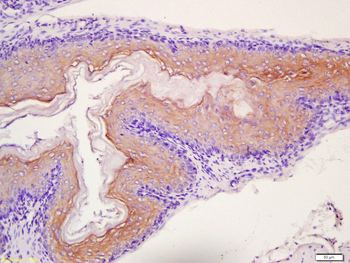 TPM2 Rabbit Polyclonal Antibody