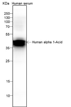 Alpha-1-acid glycoprotein 1 Recombinant Mouse Monoclonal Antibody
