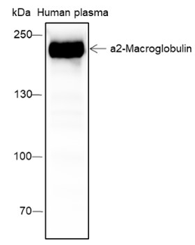 Alpha 2 Macroglobulin Recombinant Mouse Monoclonal Antibody