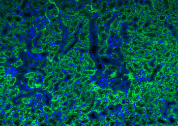 ATG5/APG5L Rabbit Polyclonal Antibody