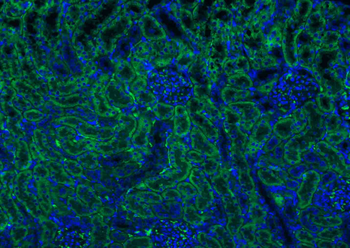 ATG5/APG5L Rabbit Polyclonal Antibody