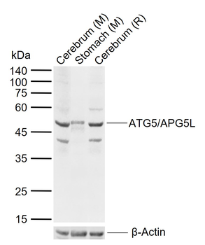ATG5/APG5L Rabbit Polyclonal Antibody