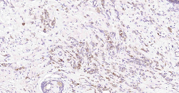 Tau-4 Mouse Monoclonal Antibody