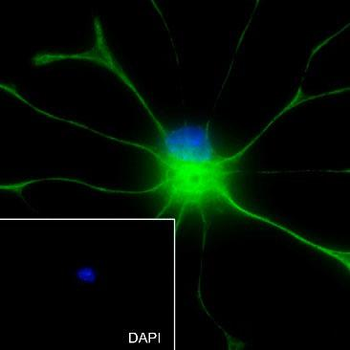 GFAP Recombinant Rabbit Monoclonal Antibody