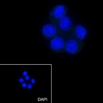 GFAP Recombinant Rabbit Monoclonal Antibody