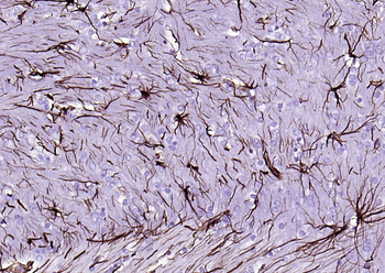 GFAP Recombinant Rabbit Monoclonal Antibody